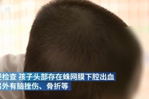 让女婴头骨骨折的"凶手"找到了！你觉得该怎么惩罚？